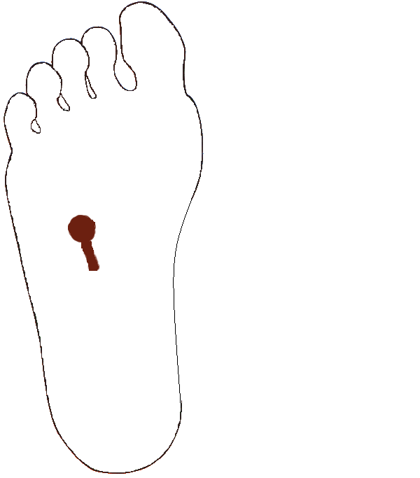 Epehólyag,epevezeték. Jobb talp