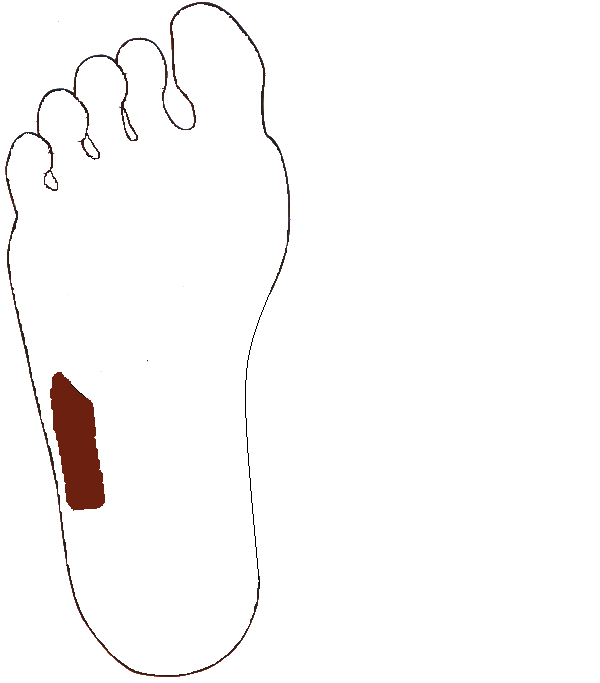 Felszállóvastagbél. Jobb talp