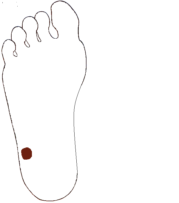 Vakbél, Féregnyúlvány. Jobb talp