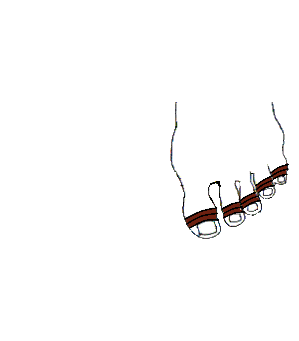 Fogak, Fogidegek. Bal lábfej