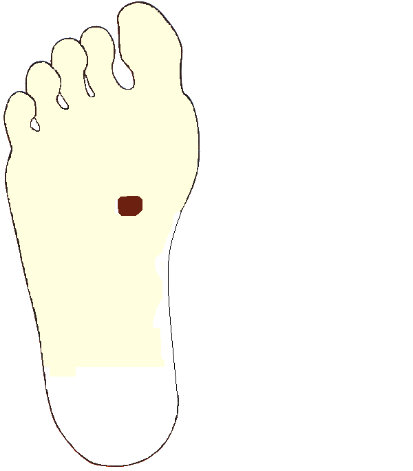 Gyomorkapu. Jobb talp