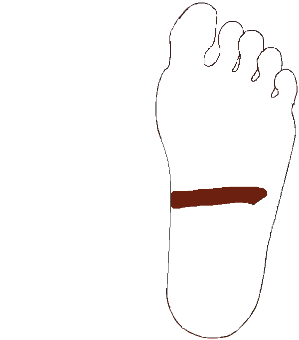 Haránt vastagbél. Bal talp