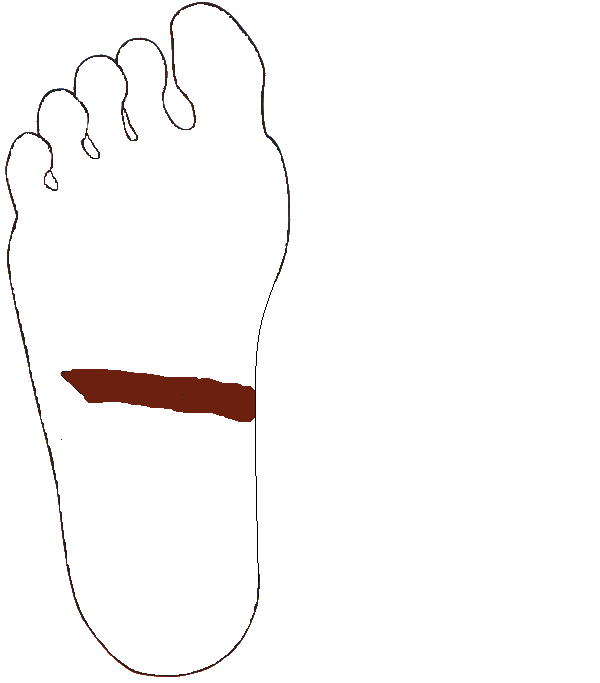 Haránt vastagbél. Jobb talp