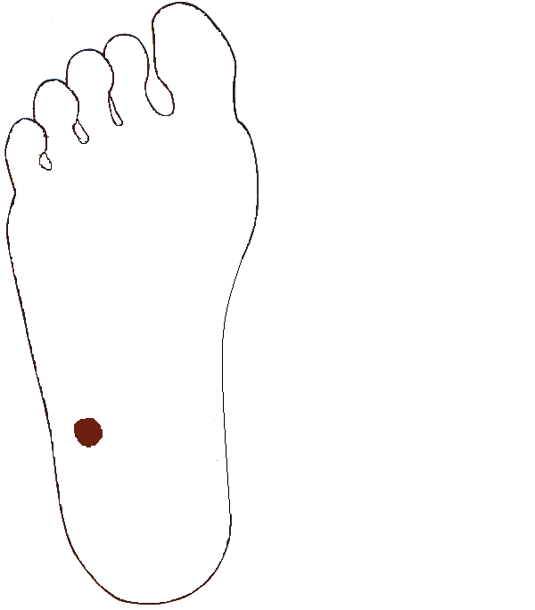 Ileocacális billentyű. Jobb talp