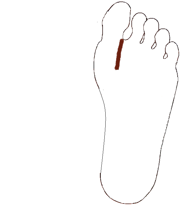 Nyelőcső. Bal talp