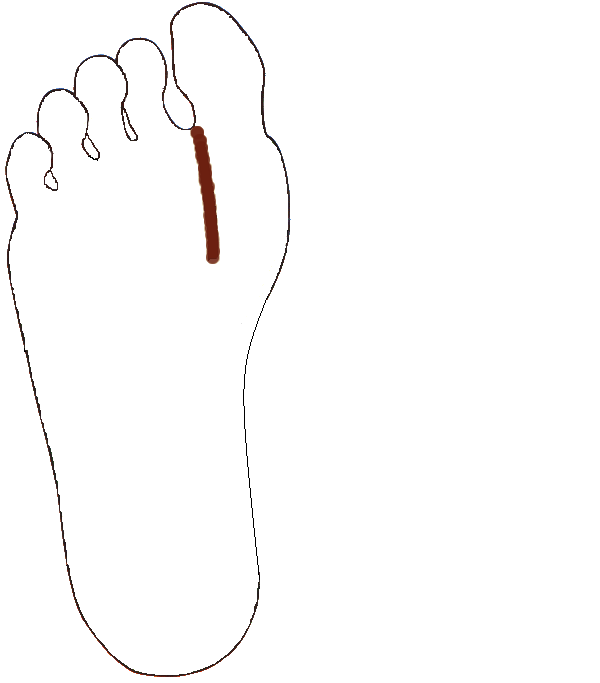 Nyelőcső. Jobb talp