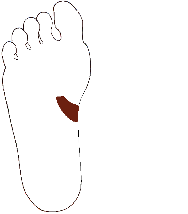 Patkóbél. Jobb talp