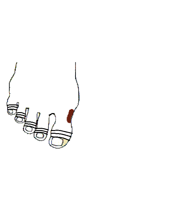 Torok, Garat. Jobb lábfej