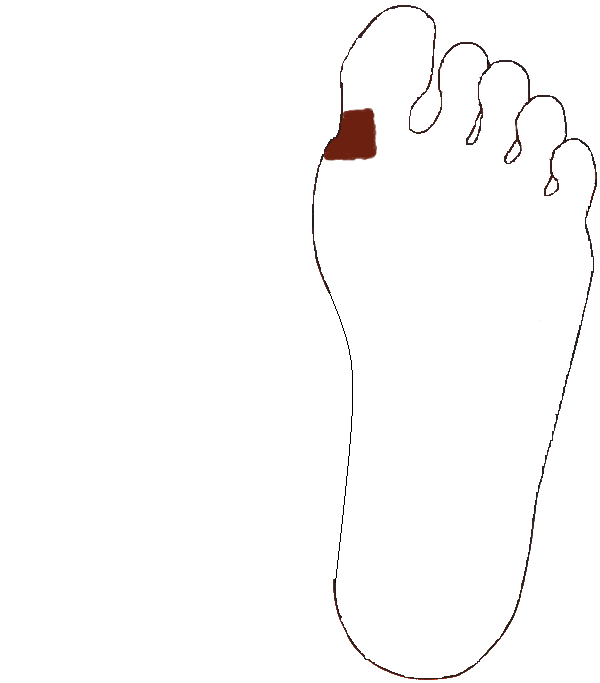 Torok, Garat. Bal talp