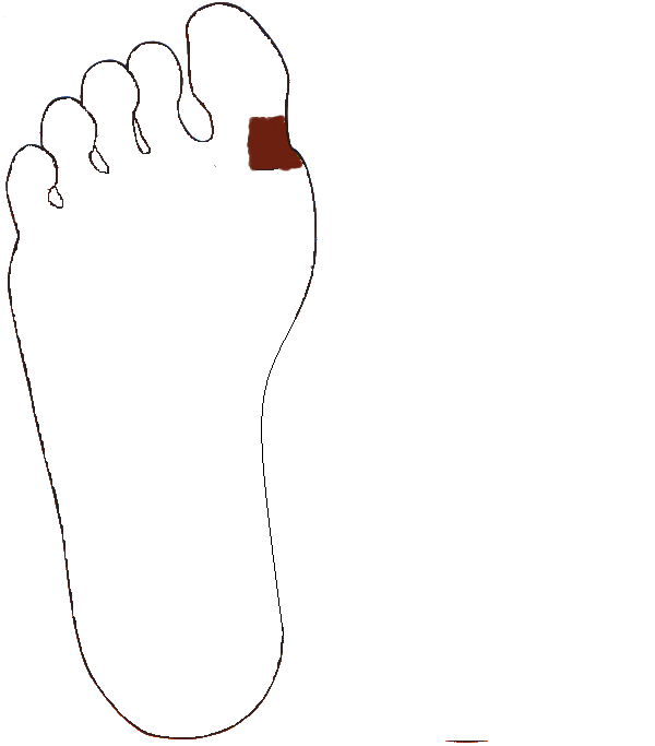 Torok, Garat. Jobb talp