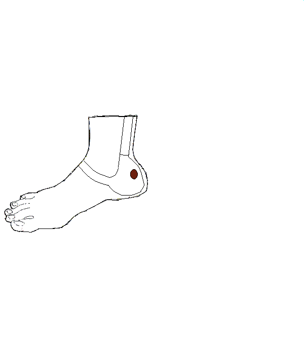 Végbélnyilás. Jobb belső