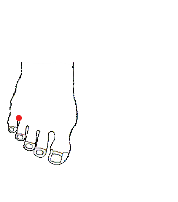 Egyensúlyszerv. Jobb lábfej