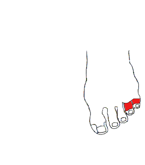 Jobb fül. Bal lábfej