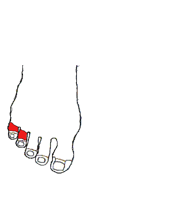 Bal fül. Jobb lábfej