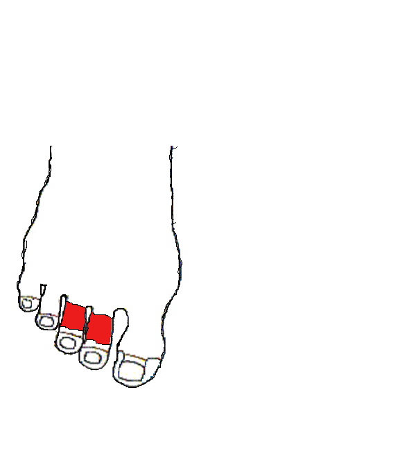 Bal szem. Jobb lábfej