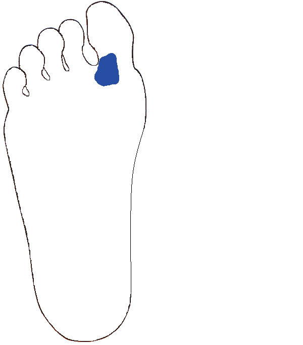 Nyakszírt, tarkó. Jobb talp