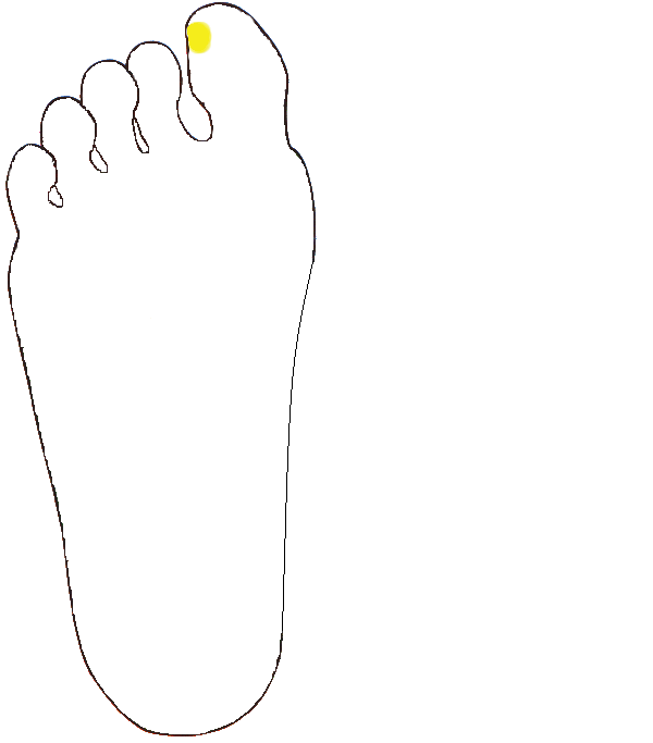 Tobozmirigy. Jobb talp