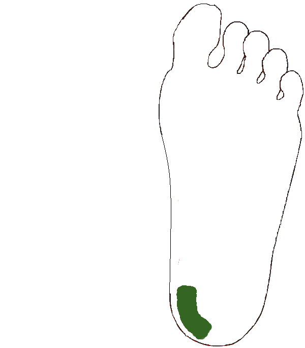 Gerinc kiegészítő. Bal talp