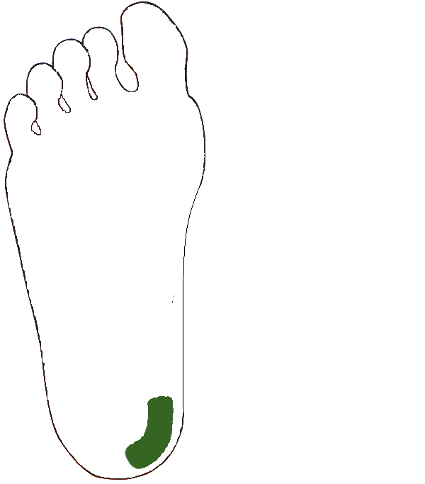 Gerinc kiegészítő. Jobb talp