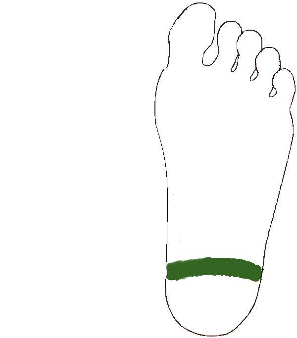 Isiász zóna. Bal talp