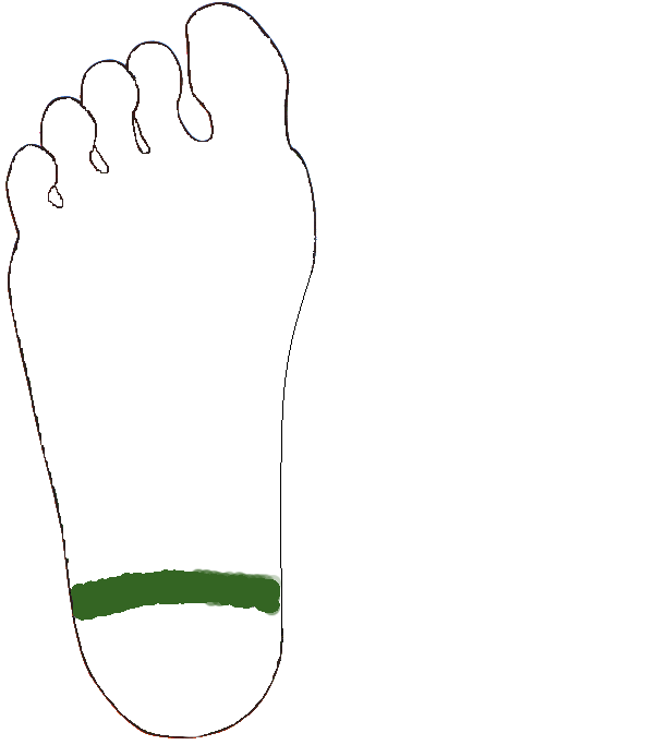 Isiász zóna. Jobb talp