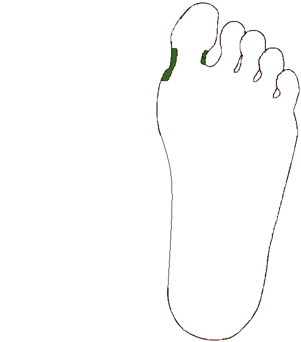 Nyakcsigolyák. Bal talp