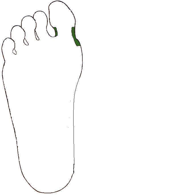 Nyakcsigolyák. Jobb talp