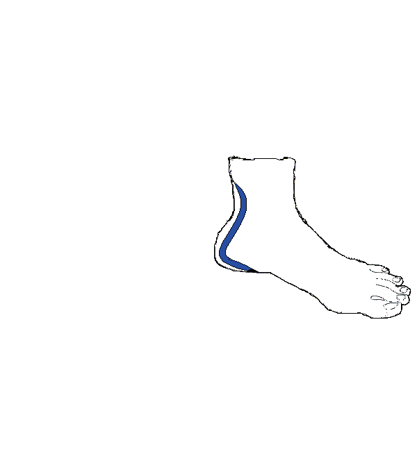 Ülőideg. Bal lábfej belső