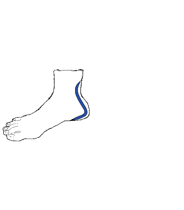 Ülőideg. Jobb lábfej belső