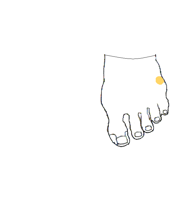 Csecsemőmirigy. Bal lábfej