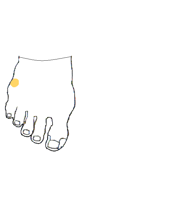 Csecsemőmirigy. Jobb lábfej