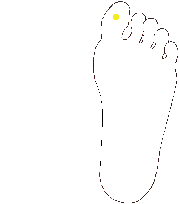 Hipofízis. Bal talp