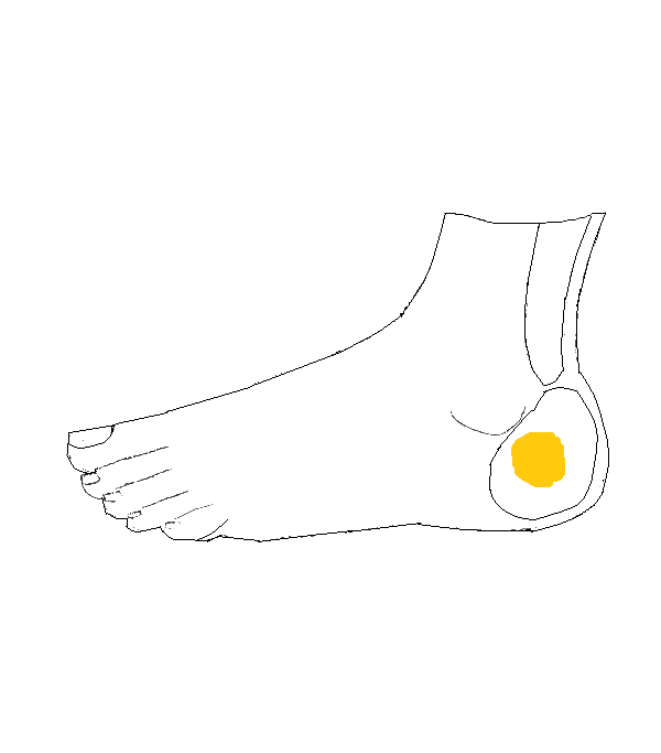 Petefészek, Here, Mellékhere. Bal külső