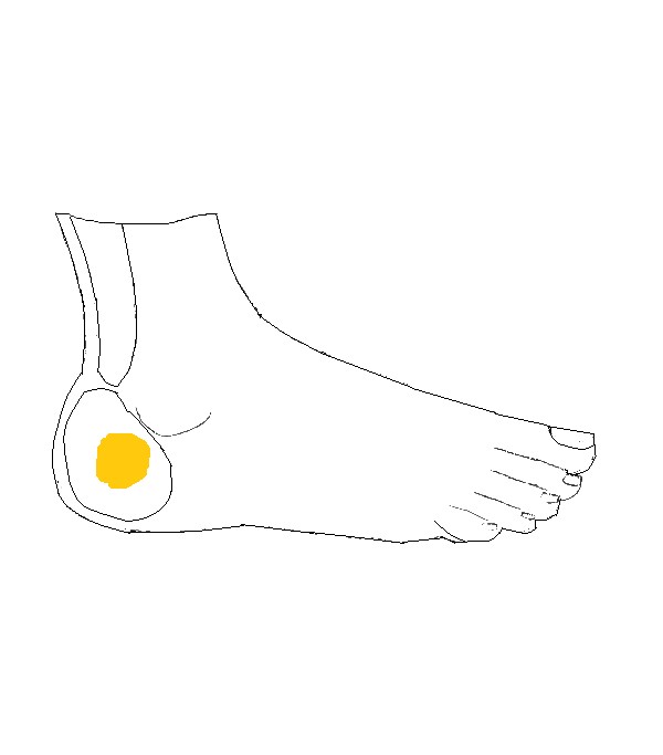 Petefészek, Here, Mellékhere. Jobb külső