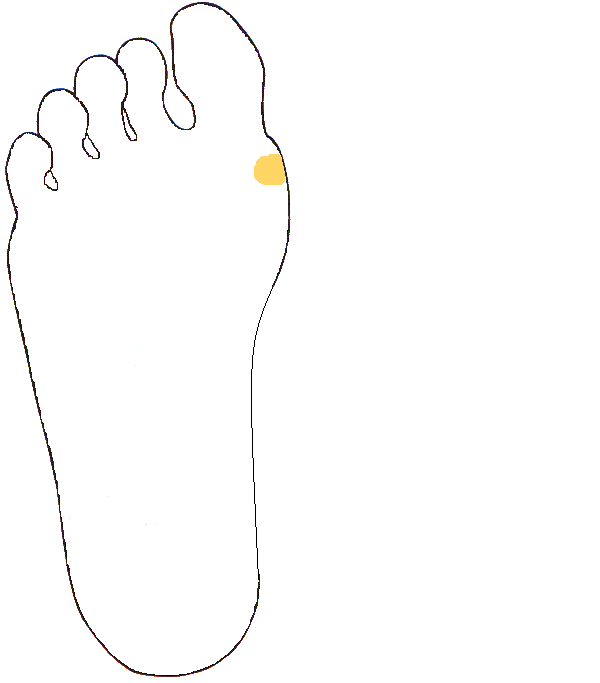 Mellékpajzsmirigy. Jobb talp