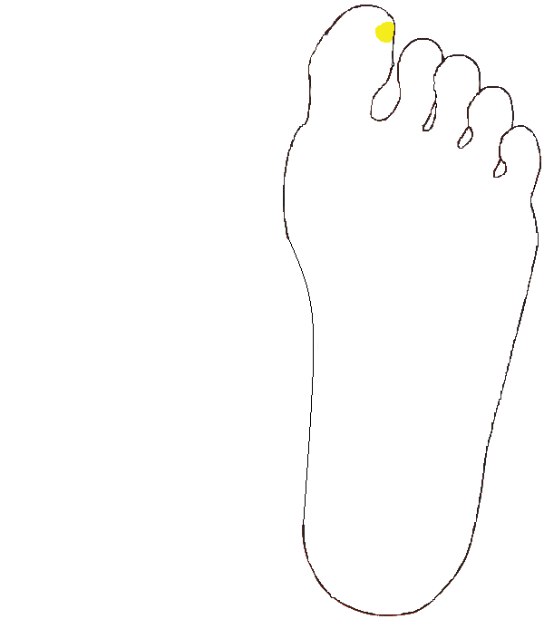 Tobozmirigy. Bal talp