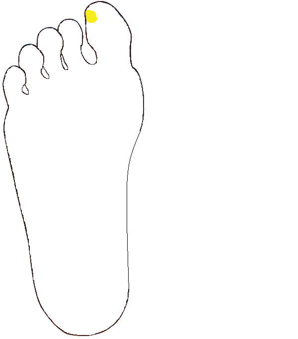 Tobozmirigy. Jobb talp