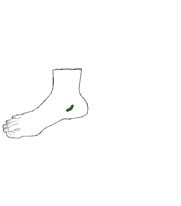 Csípő. Jobb belső