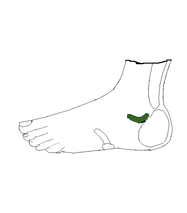 Csípő. Bal külső