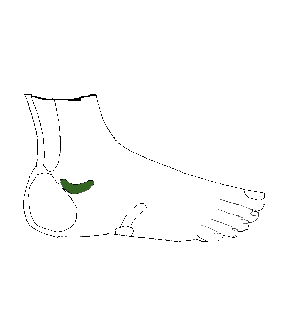 Csípő. Jobb külső