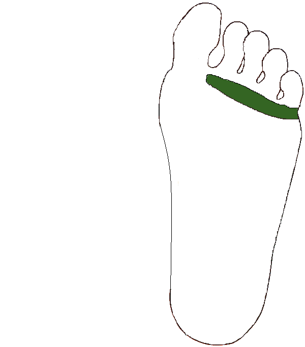 Csuklyás izom. Bal talp