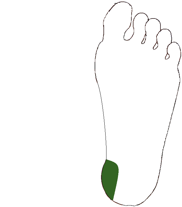 Sarokpárna külső. Bal talp