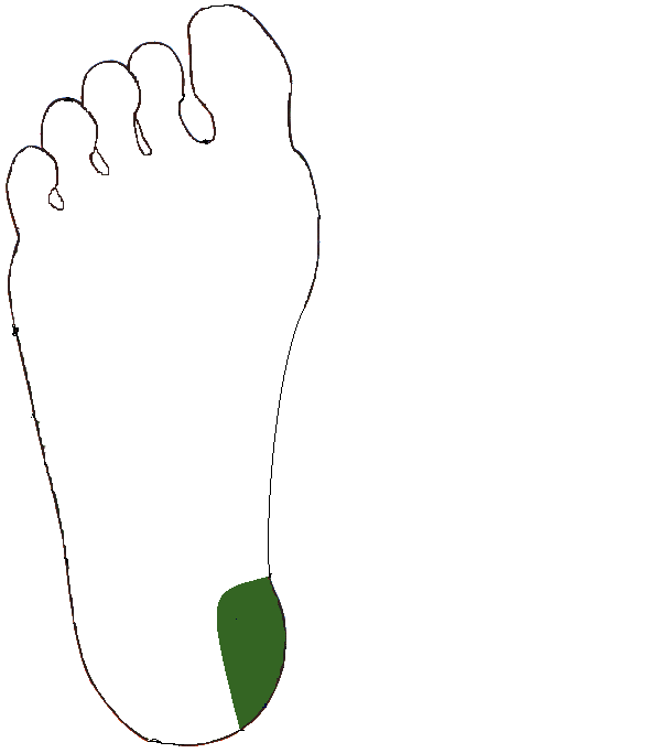 Sarokpárna külső. Jobb talp