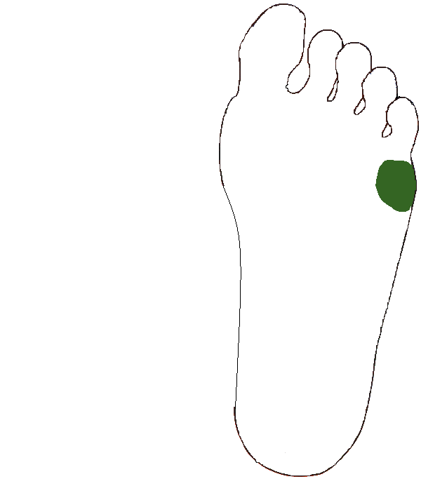 Váll izület. Bal talp