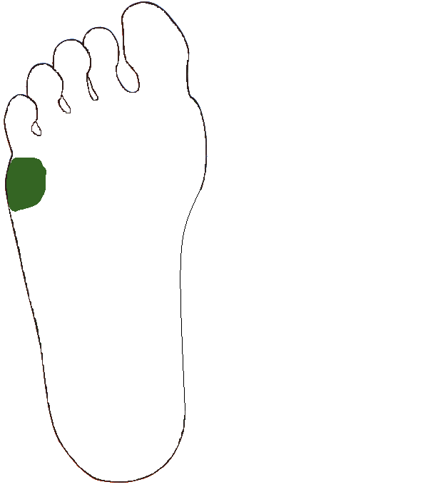 Váll izület. Jobb talp