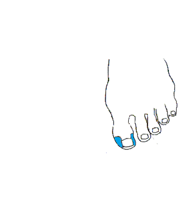 Arcüreg. Bal lábfej