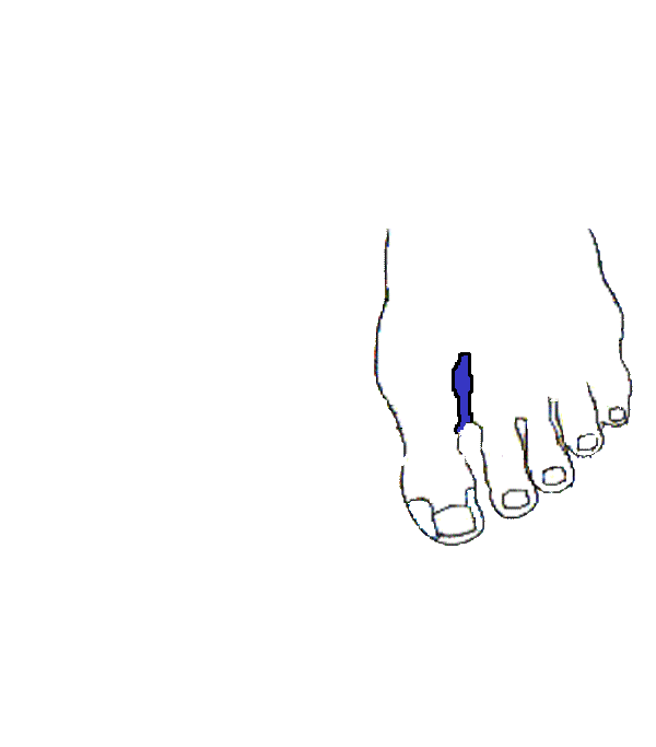 Légcső. Bal lábfej