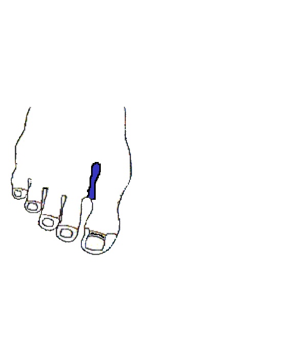 Légcső. Jobb lábfej