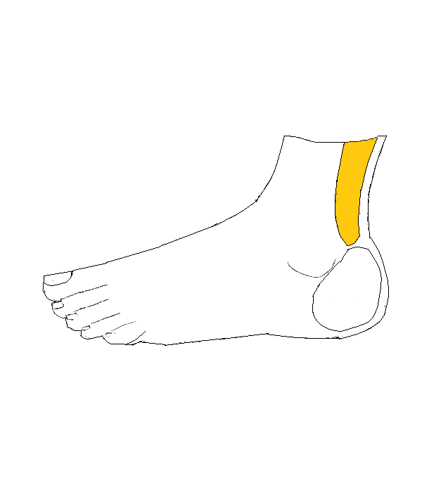 Ivarmirigyek kiegészítő zóna. Bal külső