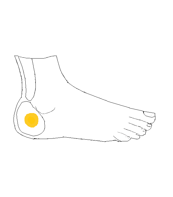 Petefészek, Here, Mellékhere Jobb külső